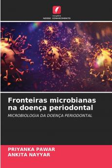 Fronteiras microbianas na doença periodontal