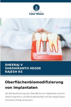 Oberflächenbiomodifizierung von Implantaten