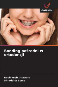 Bonding pośredni w ortodoncji