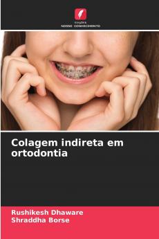 Colagem indireta em ortodontia