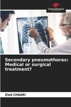 Secondary pneumothorax