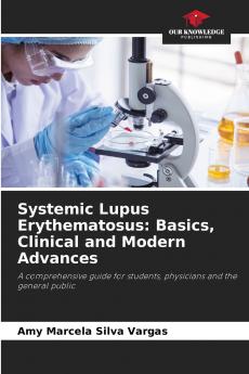 Systemic Lupus Erythematosus
