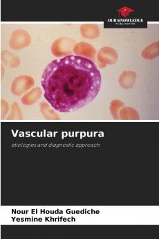 Vascular purpura