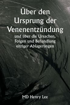 Über den Ursprung der Venenentzündung  und über die Ursachen Folgen und Behandlung eitriger Ablagerungen