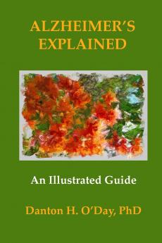 Alzheimer's Explained An Illustrated Guide