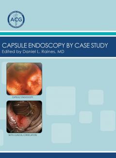 Capsule Endoscopy by Case Study Volume 2