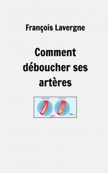 Comment déboucher ses artères