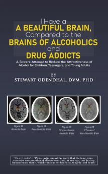 I Have a Beautiful Brain Compared to the Brains of Alcoholics and Drug Addicts
