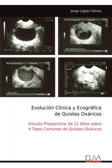 Evolución Clínica y Ecográfica de Quistes Ováricos