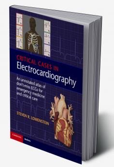 Critical Cases in Electrocardiography