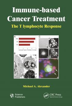 Immune-based Cancer Treatment