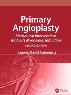 Primary Angioplasty