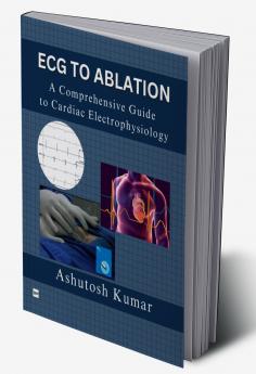 ECG TO ABLATION: A COMPREHENSIVE GUIDE TO CARDIAC ELECTROPHYSIOLOGY
