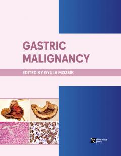 Gastric Malignancy