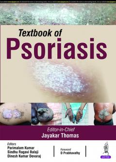 Textbook of Psoriasis