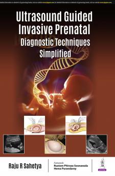 ULTRASOUND GUIDED INVASIVE PRENATAL DIAGNOSTIC TECHNIQUES SIMPLIFIED