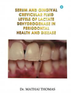 SERUM  AND GINGIVAL CREVICULAR  FLUID LEVELS OF LACTATE DEHYDROGENASE IN PERIODONTAL HEALTH AND DISEASE