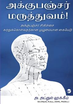 Acupuncture Maruthuvam: Acupuncture Sigichai Katrukolvatharkaana Muzhumayana Kaiyedu!