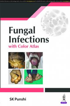 Fungal infections with Color Atlas by SK Punshi