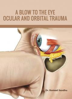 A Blow to The Eye: Ocular and Orbital Trauma