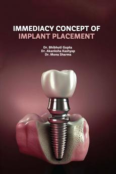 IMMEDIACY CONCEPT OF IMPLANT PLACEMENT