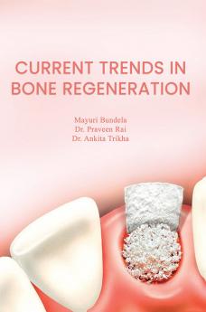 Current Trends In Bone Regeneration