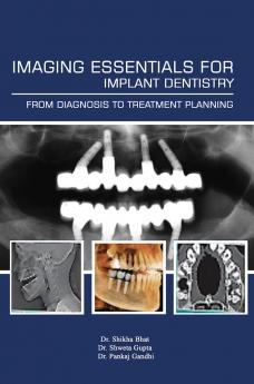 Imaging Essentials for Implant Dentistry from Diagnosis to Treatment Planning