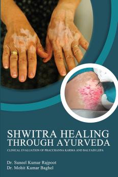 Shwitra Healing through Ayurveda: Clinical Evaluation of Pracchanna Karma and Balyadi Lepa