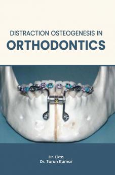 DISTRACTION OSTEOGENESIS IN ORTHODONTICS