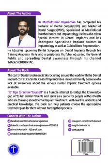 How to Get Dental Implant Screws Without Cutting Up Your Credit Cards: 17 Tips to Screw Yourself