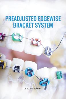 Preadjusted Edgewise Bracket System