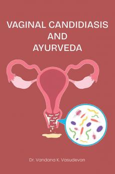Vaginal Candidiasis And Ayurveda