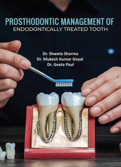 Prosthodontic Management of Endodontically Treated Tooth