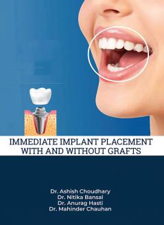 IMMEDIATE IMPLANT PLACEMENT WITH AND WITHOUT GRAFTS