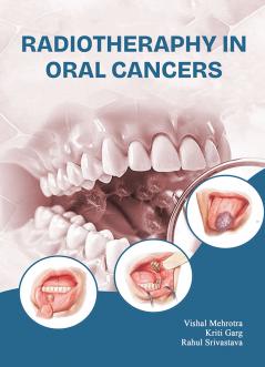 Radiotheraphy In Oral Cancers