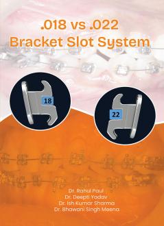 0.018 VS 0.022  Bracket Slot System