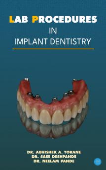 Lab Procedures in Implant Dentistry