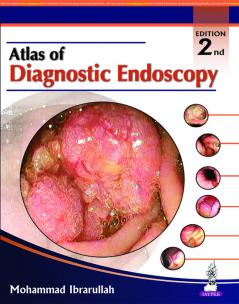 Atlas of Diagnostic Endoscopy