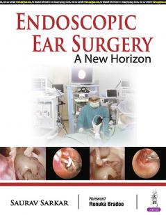 ENDOSCOPIC EAR SURGERY A NEW HORIZON
