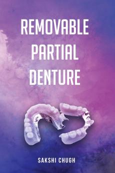Removable Partial Denture