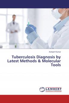 Tuberculosis Diagnosis by Latest Methods & Molecular Tools