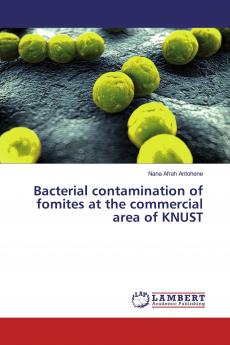 Bacterial contamination of fomites at the commercial area of KNUST