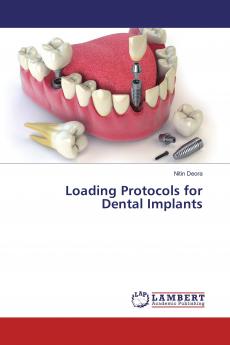 Loading Protocols for Dental Implants