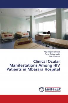 Clinical Ocular Manifestations Among HIV Patients in Mbarara Hospital