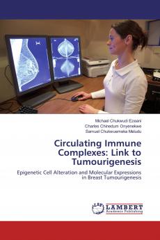 Circulating Immune Complexes: Link to Tumourigenesis