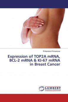 Expression of TOP2A mRNA BCL-2 mRNA & KI-67 mRNA in Breast Cancer