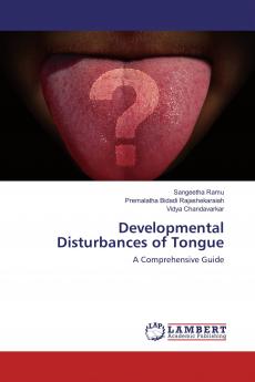 Developmental Disturbances of Tongue
