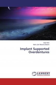 Implant Supported Overdentures