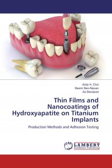 Thin Films and Nanocoatings of Hydroxyapatite on Titanium Implants