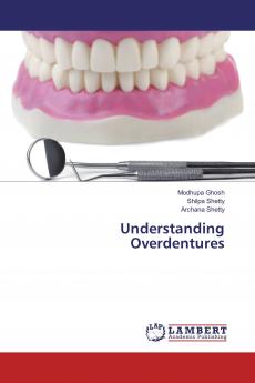 Understanding Overdentures